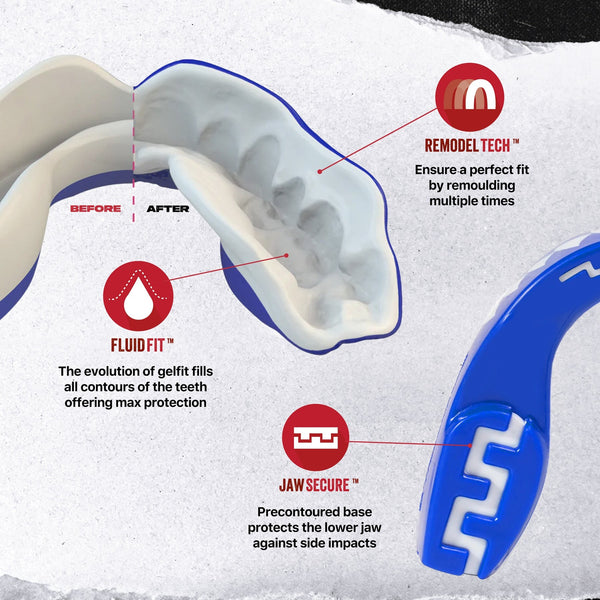 SafeJawz Extro Mouth Guard Shark