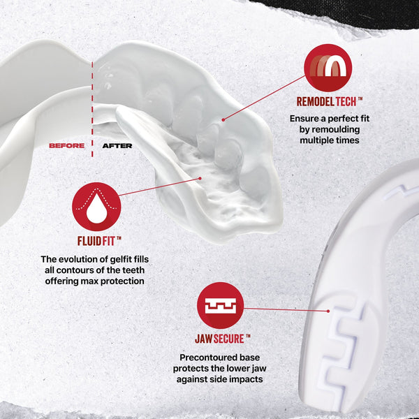 SafeJawz Intro Mouthguard White